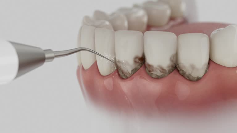 Trusted Dental Crowns And Bridges service in Lakeside, OR - Dentist Open Now